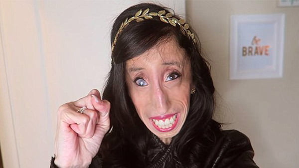 This is Lizzie Velásquez in 2022 - Story Url