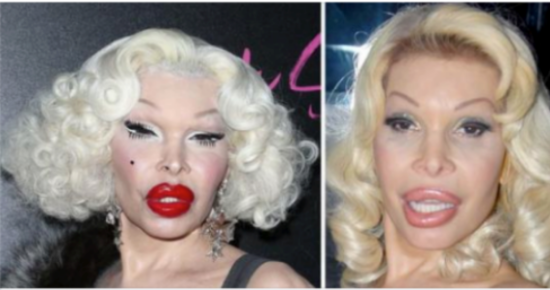 The ‘most expensive body in the world’ belongs to Amanda Lepore and ...